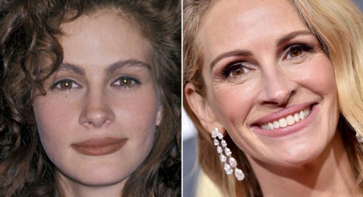 Did Julia Roberts Get Plastic Surgery Including Lips And Nose Job