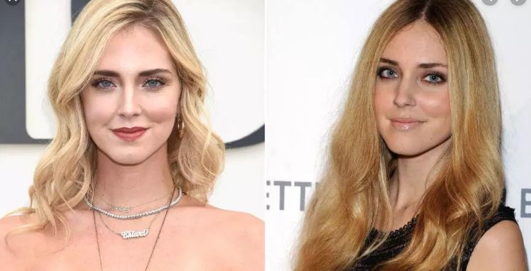 Chiara Ferragni Before and After Plastic Surgery Including Boob Job and ...