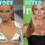 Heidi Klum Boob Job