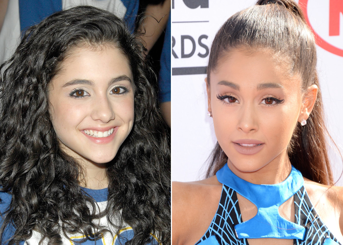 Ariana Grande Nose Job Before After Plastic Surgery 