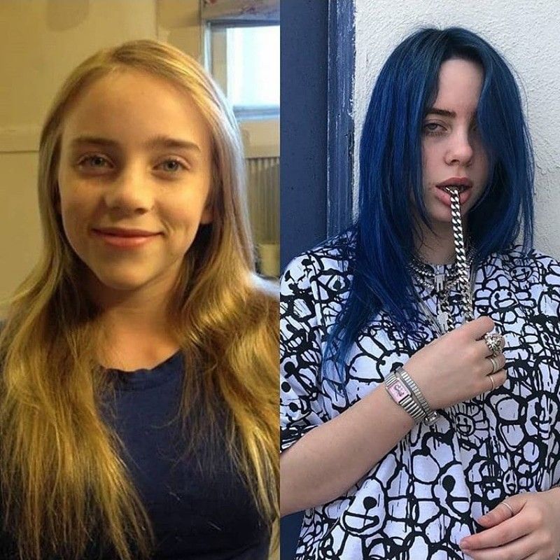 Did Billie Eilish Undergo Plastic Surgery Including Boob Job, Nose Job ...