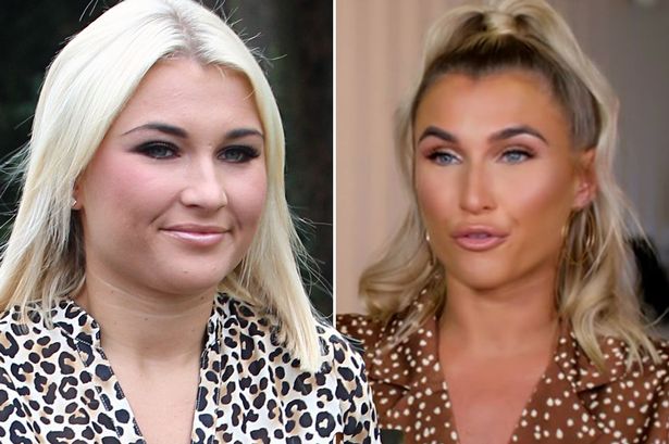 Did Billie Faiers Undergo Plastic Surgery Including Boob Job Nose Job Botox And Lips Famous