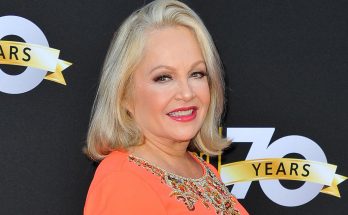 Charlene Tilton Plastic Surgery Nose Job Boob Job Botox Lips