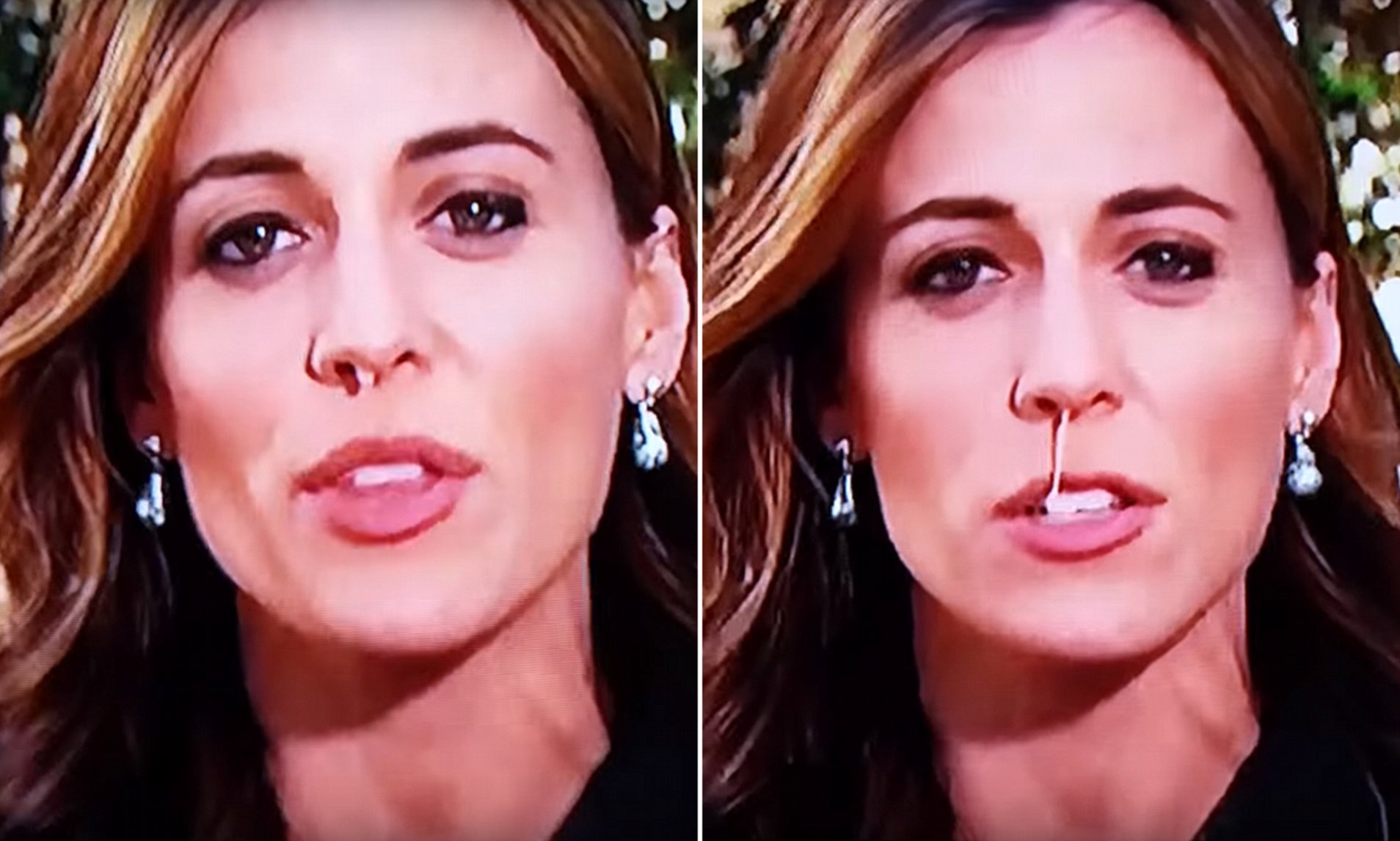 Did Hallie Jackson Undergo Plastic Surgery Including Boob