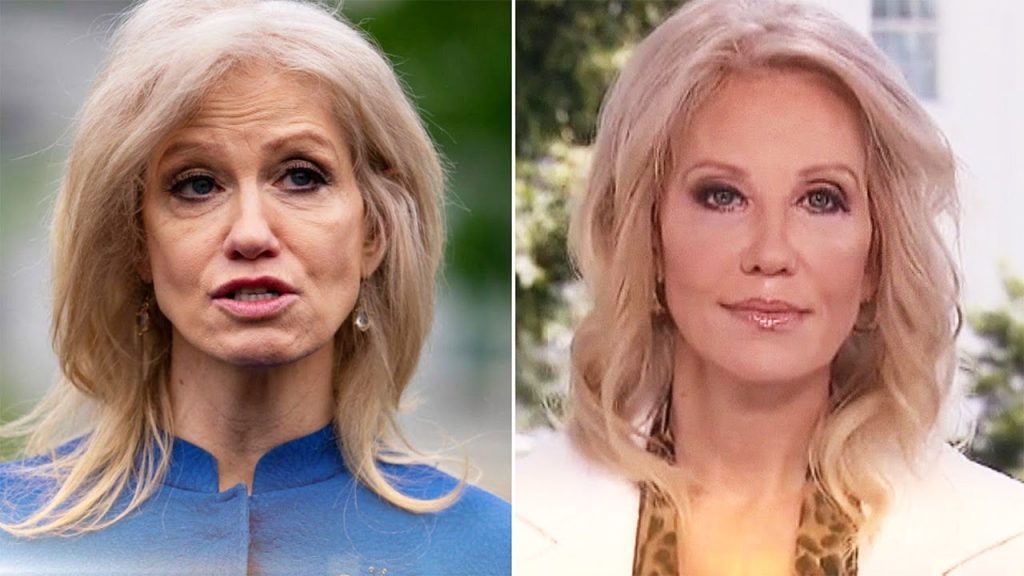 Did Kellyanne Conway Undergo Plastic Surgery Including Boob Job, Nose