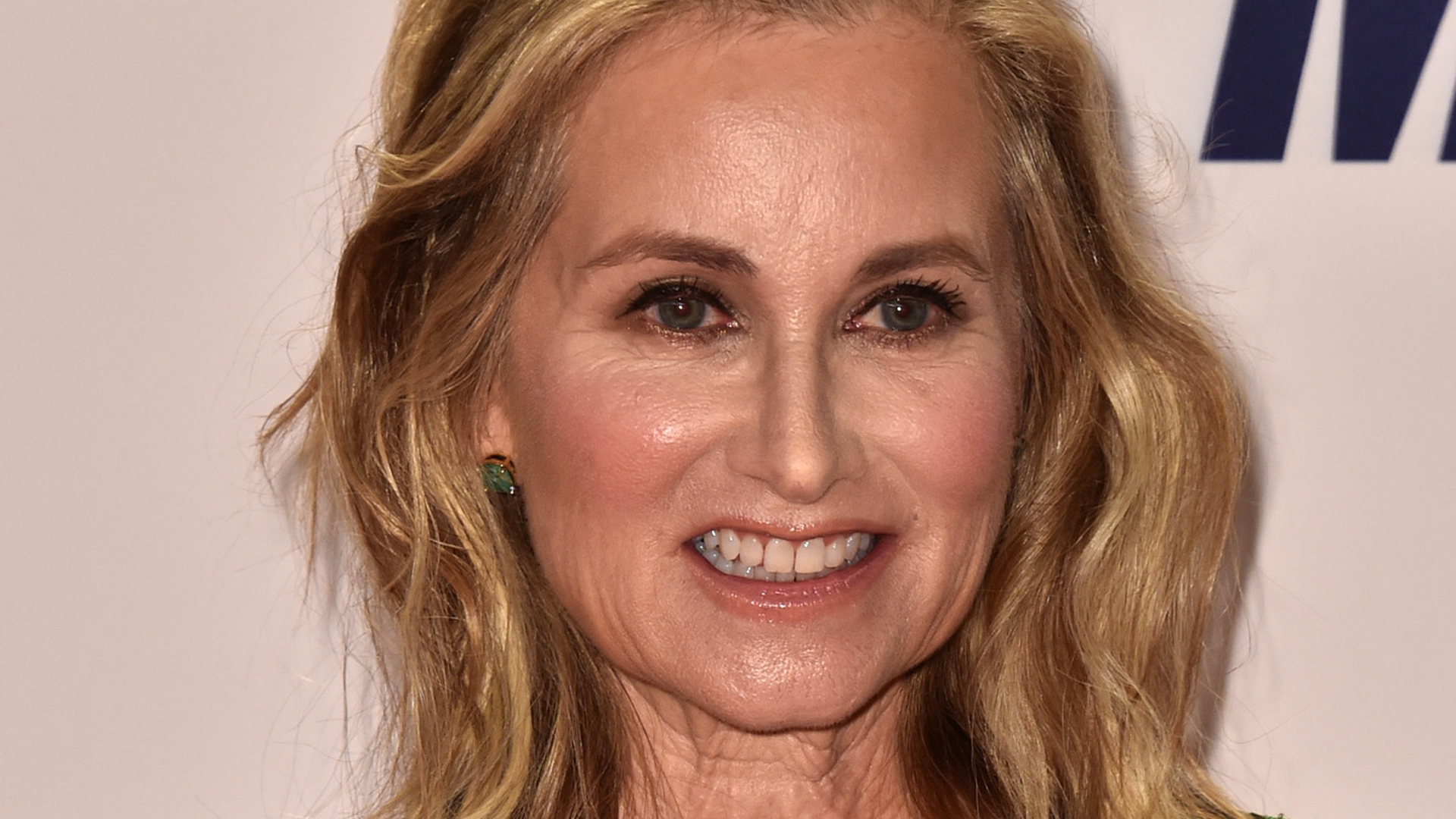 Did Maureen McCormick Undergo Plastic Surgery Including Boob Job, Nose