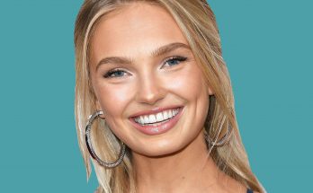 Romee Strijd Plastic Surgery Nose Job Boob Job Botox Lips