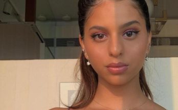 Suhana Khan Cosmetic Surgery