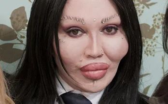 Pete Burns