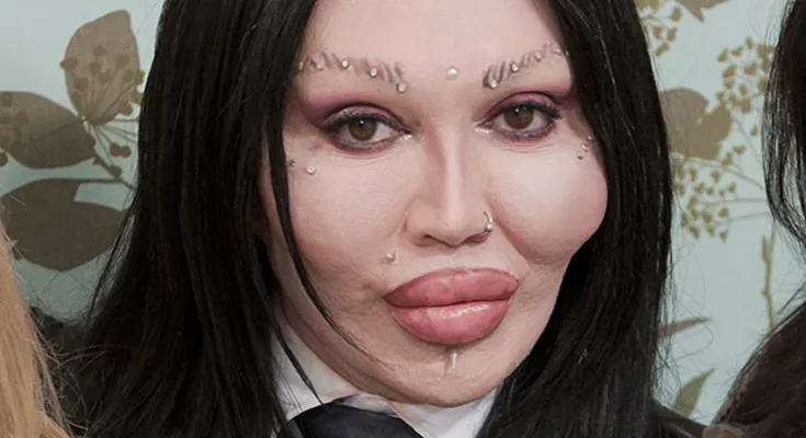 Pete Burns